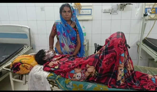 ललितपुर में पति ने पत्नी को लगाई आग,हालत गम्भीर