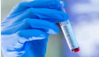 ملک میں کورونا انفیکشن کے فعال کیسز کی تعداد تقریباً سات ہزار